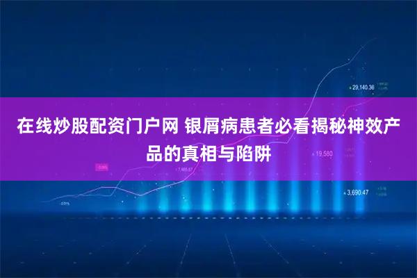 在线炒股配资门户网 银屑病患者必看揭秘神效产品的真相与陷阱